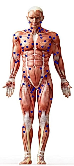 Image of trigger point locations on the front side of the body.