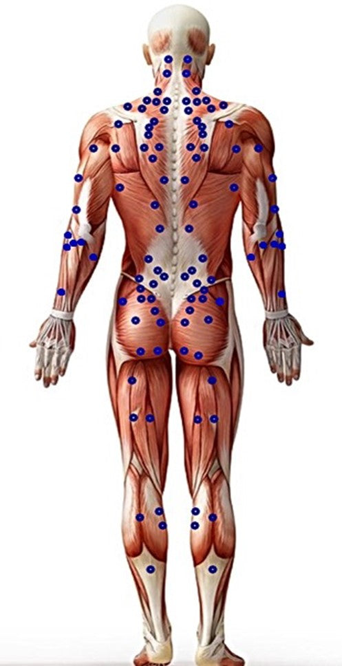 click locations on the back side of the body to learn more about trigger points