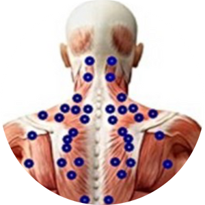 Trigger point map showing upper back trigger point locations for pain relief - interactive guide for KNUKLBALL precision therapy